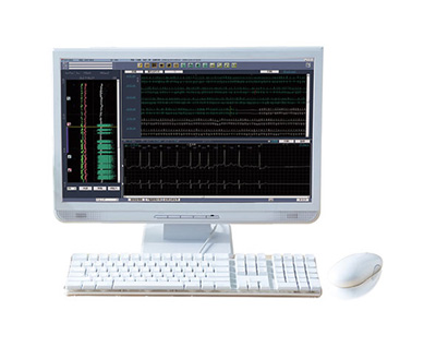 ホルター心電図解析